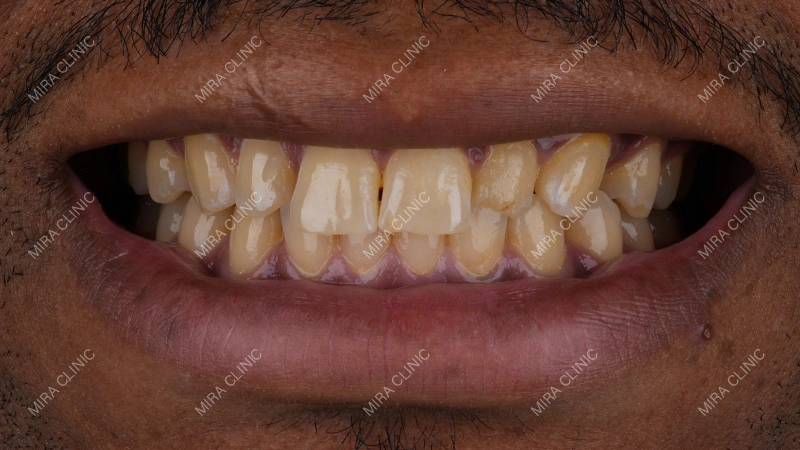 Change About His Smile
